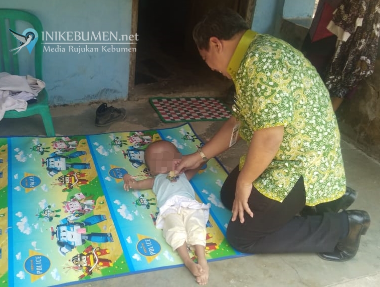 Nestapa Muhammad Nur, Balita Asal Sruweng yang Menderita Hidrosefalus